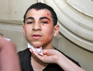 Подросток, убегая от полиции, разбил голову о щит. Баку, 14 мая 2012 г. Фото ИА "Туран"