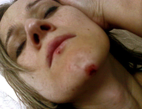 Сапият Магомедова после избиения 17 июля 2010 года. Фото предоставлено Правозащитным центром "Мемориал" Сапият Магомедова после избиения 17 июля 2010 года. Фото предоставлено Правозащитным центром "Мемориал"