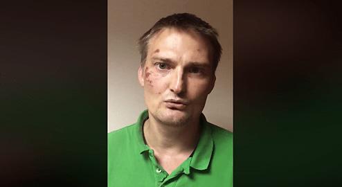 Адвокат Михаил Беньяш после задержания и избиения. Кадр видео, опубликованного адвокатом Алексеем Аванесяном в Facebook https://www.facebook.com/100005066893432/videos/1039600016218885/ Адвокат Михаил Беньяш после задержания и избиения. Кадр видео, опубликованного адвокатом Алексеем Аванесяном в Facebook https://www.facebook.com/100005066893432/videos/1039600016218885/