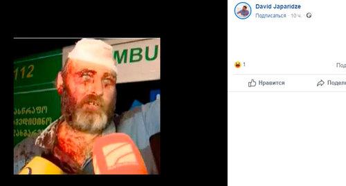 Беслан Кмузов после нападения. Фото: сnраница FB
Otari Smoia https://www.facebook.com/beslan.kmuzoff?__tn__=%2CdK-R-R&eid=ARAI0RU3cbUBdXmvQjy_WrvigMQE1u8YWaKFSRuzbZ2IYO2j7XNgR9EfkH-Em9Vurnyu5EL05c7yT6_V&fref=mentions Беслан Кмузов после нападения. Фото: сnраница FB
Otari Smoia https://www.facebook.com/beslan.kmuzoff?__tn__=%2CdK-R-R&eid=ARAI0RU3cbUBdXmvQjy_WrvigMQE1u8YWaKFSRuzbZ2IYO2j7XNgR9EfkH-Em9Vurnyu5EL05c7yT6_V&fref=mentions