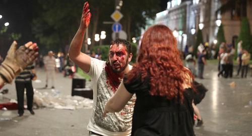 Пострадавший во время акции протеста в Тбилиси. 21 июня 2019 г. Фото: REUTERS/Irakli Gedenidze Пострадавший во время акции протеста в Тбилиси. 21 июня 2019 г. Фото: REUTERS/Irakli Gedenidze