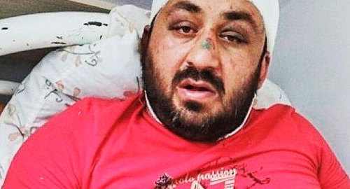 Житель Хасавюрта Ислам Саритов. Фото ПЦ "Мемориал" https://memohrc.org/ru/news_old/v-dagestane-byvshiy-policeyskiy-zhestoko-izbil-mestnogo-zhitelya Житель Хасавюрта Ислам Саритов. Фото ПЦ "Мемориал" https://memohrc.org/ru/news_old/v-dagestane-byvshiy-policeyskiy-zhestoko-izbil-mestnogo-zhitelya