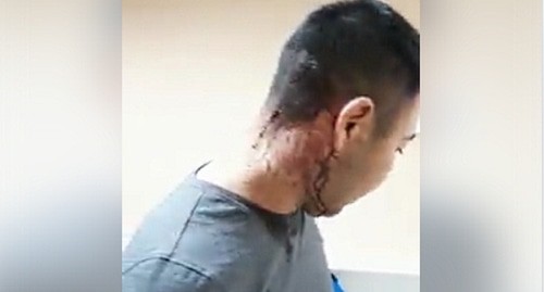 Арслан Кусьминов после нападения. скриншот видео https://www.facebook.com/people/Арслан-Кусьминов/100006289414442 Арслан Кусьминов после нападения. скриншот видео https://www.facebook.com/people/Арслан-Кусьминов/100006289414442