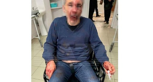 Избитый нальчикский учитель. Скриншот публикации https://t.me/bazabazon/5271 Избитый нальчикский учитель. Скриншот публикации https://t.me/bazabazon/5271