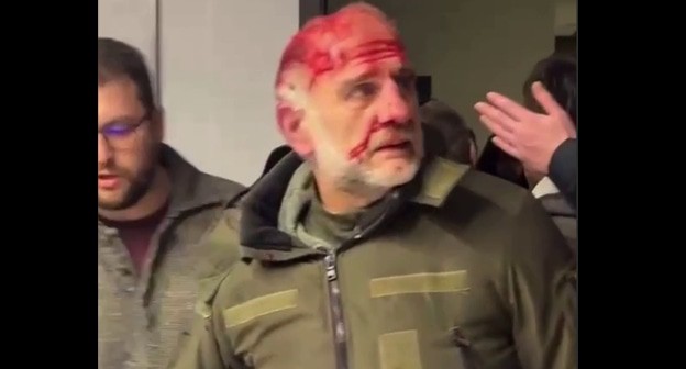 Избитый активисты партии "Ахали", стоп-кадр видео телеграм-канала "Грузия 24" https://t.me/georgia_24/6315 Избитый активисты партии "Ахали", стоп-кадр видео телеграм-канала "Грузия 24" https://t.me/georgia_24/6315